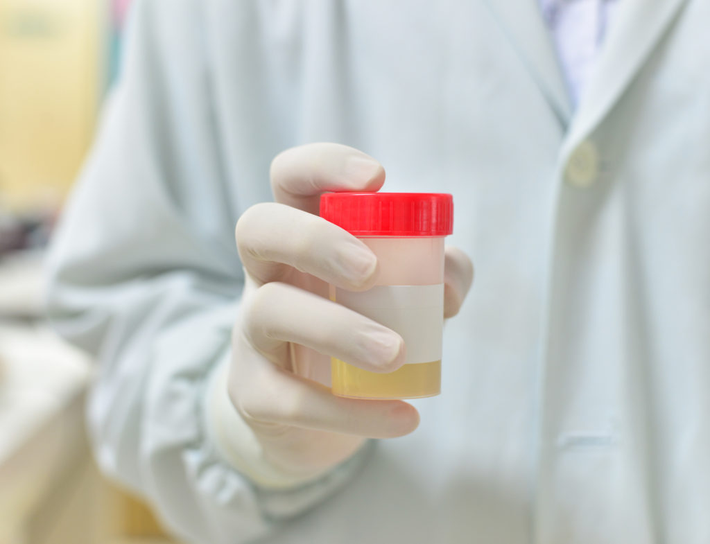 How to Choose High-Quality Synthetic Urine Products